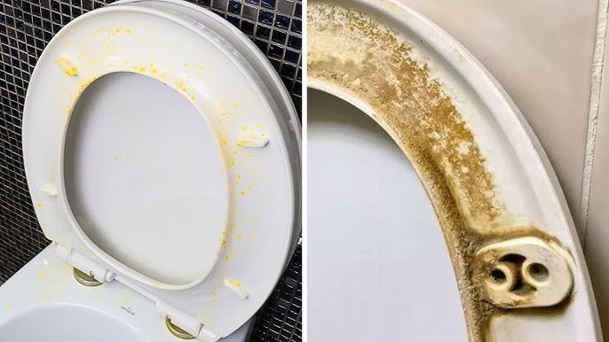 How to Remove Urine Stains from Toilet Seat: Easy & Effective Tips