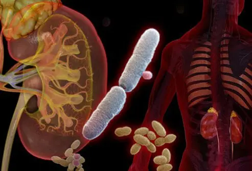 Can You Get Urinary Tract Infections from Toilet Seats? Truth Revealed